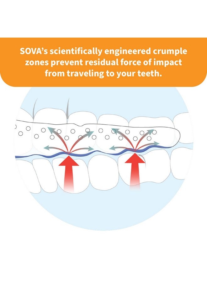 SOVA Junior Night Guard, Purple Punch - 1.6mm Thin - Custom-Molded Fit - Protects Against Nighttime Teeth Grinding & Clenching - FSA/HSA Eligible - Odor & Taste Free - Remoldable Up to 20 Times - Image 5