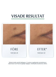 يوسيرين سائل مرطب مضاد للتصبغ مع واقي شمس +30 من يوسرين - 50مل  - Image 2
