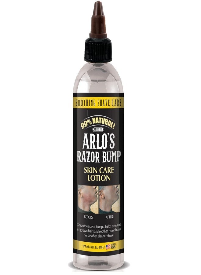 Arlo's Razor Bump Skin Care Lotion 6 oz. - Image 1