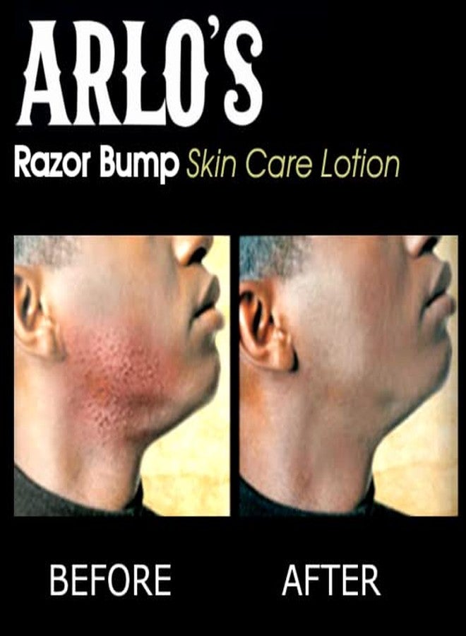 Arlo's Razor Bump Skin Care Lotion 6 oz. - Image 3