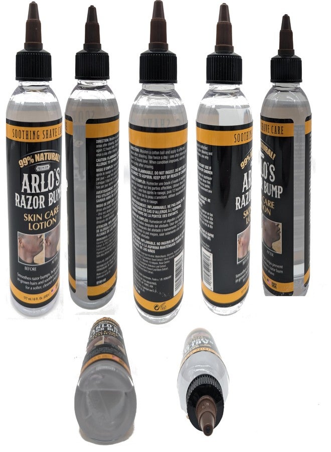Arlo's Razor Bump Skin Care Lotion 6 oz. - Image 2