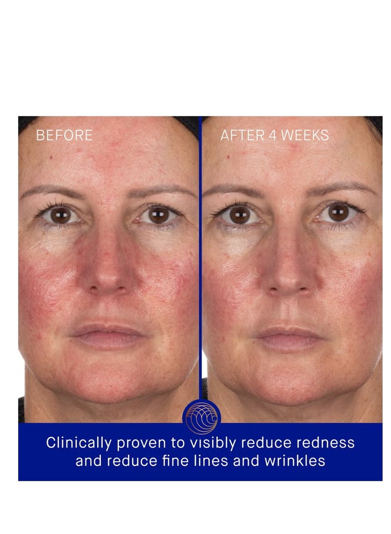 أوجستينوس بادر قناع الوجه الهيدروجيل من أوغسطينوس بادر (عبوة من 6 قطع) - Image 3