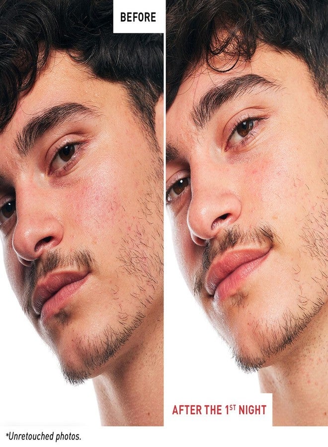 erborian زيت-سيروم ليلي متعدد التحسينات للعناية بالبشرة - مشحون بـ 17 مكون - يستهدف 7 مشاكل جلدية - يحسن مظهر الخطوط الدقيقة، وملمس البشرة، وتجانس اللون (0.33 أونصة سائلة) - Image 2