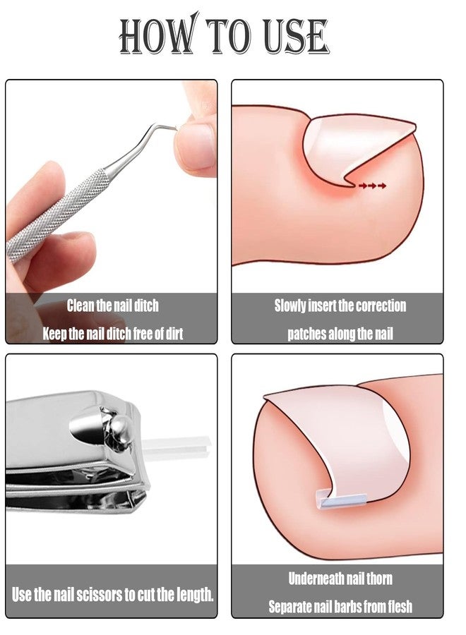 squishy 102Pcs Ingrown Toe Nail Remover, Ingrown Toenail Correction Tool Kit, Include Toenail Corrector Strips, Filling Pads and Nail Lifter for Daily Foot Care, Travel Essential - Image 5