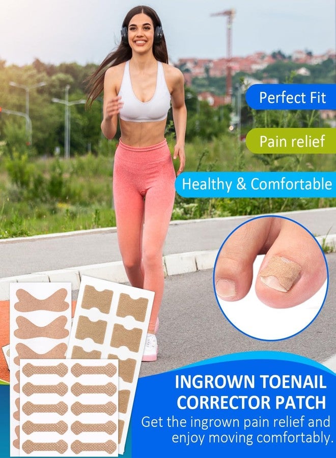 squishy 102Pcs Ingrown Toe Nail Remover, Ingrown Toenail Correction Tool Kit, Include Toenail Corrector Strips, Filling Pads and Nail Lifter for Daily Foot Care, Travel Essential - Image 2