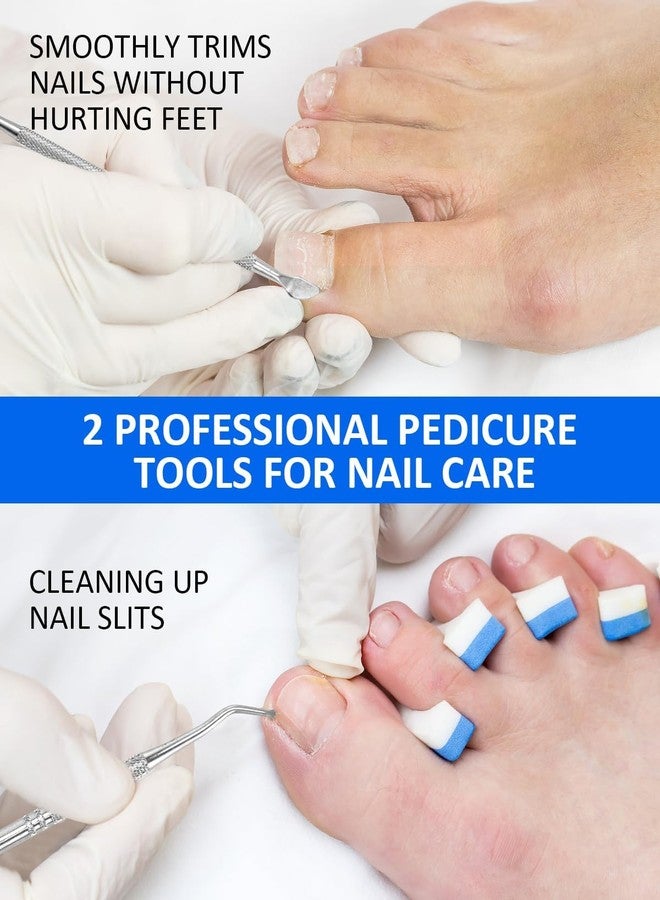 squishy 102Pcs Ingrown Toe Nail Remover, Ingrown Toenail Correction Tool Kit, Include Toenail Corrector Strips, Filling Pads and Nail Lifter for Daily Foot Care, Travel Essential - Image 4