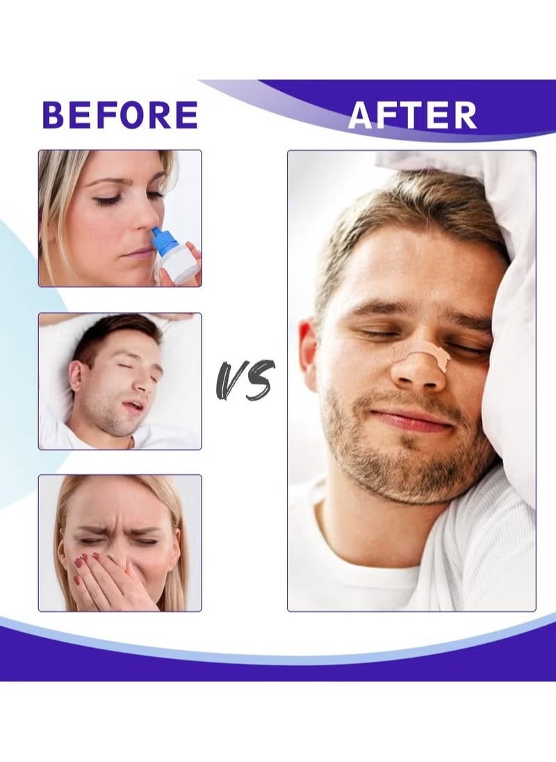Sefudun Nasal Strips, Breathe Nose Strips to Reduce Snoring and Relieve Nose Congestion Works Instantly to Improve Sleep, Relieve Nasal Congestion Due to Colds & Allergy, 11.5*2.5*15.3 cm(30Pcs)  - Image 3