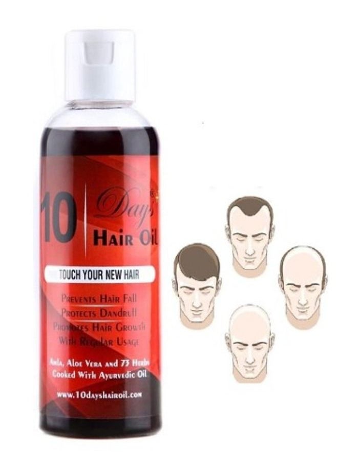 Generic - Hair Oil 10 Days Regrowth And Stop Hair Loss 100 ML - Image 1