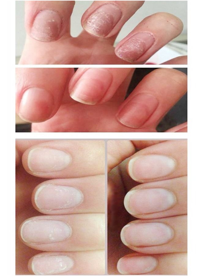 CND - CND RescueRxx ​Daily Keratin Treatment 15 ml - Image 1
