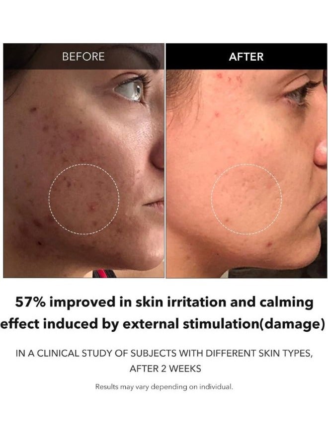 APRILSKIN سيروم كاروتين الم clarifying 37 مل - Image 5