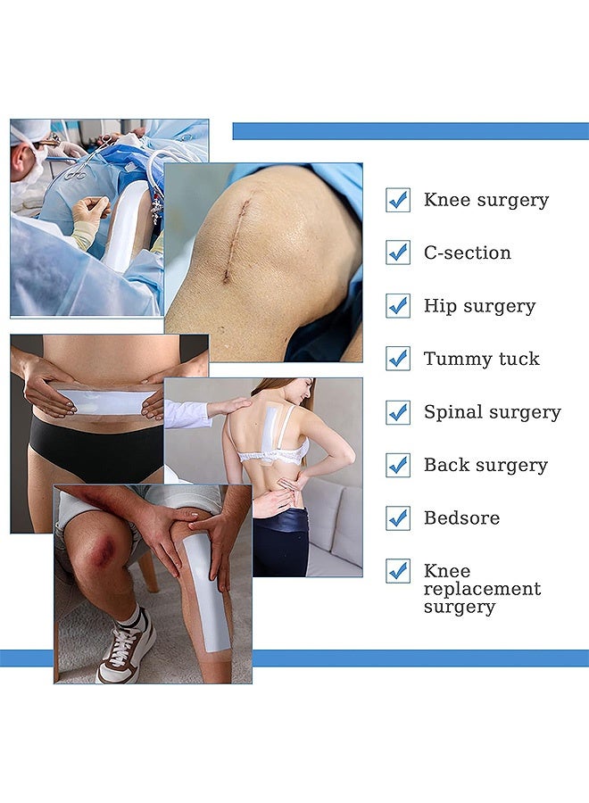 إم إكس إن ضمادة طويلة مقاومة للماء مكونة من 7 قطع، واقيات ندبات الاستحمام، ضمادات غسيل الكلى البريتوني، غطاء الجروح، ضمادة واقية - Image 3