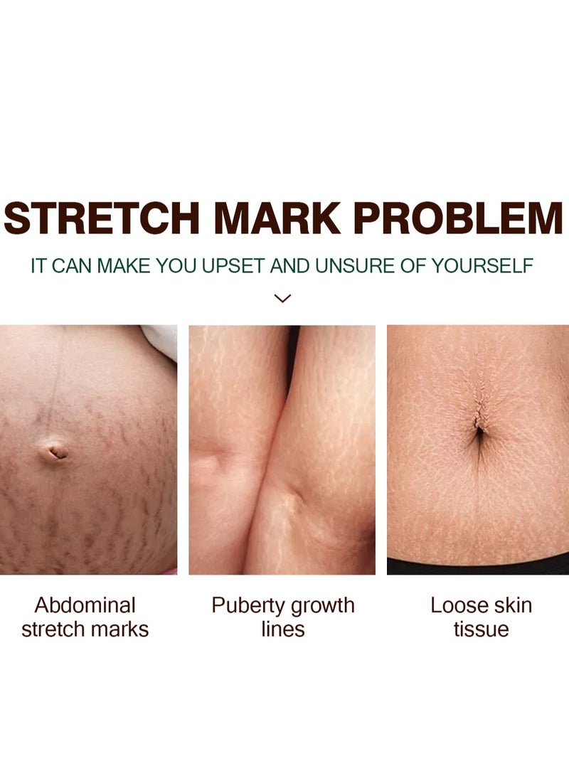 MOOYAM Stretch Marks Oil Natural for Pregnant Scars Repair Prevents and Lighten Stretch Marks Improves Skin Elasticity and Dullness for Women and Men 100ml - Image 4