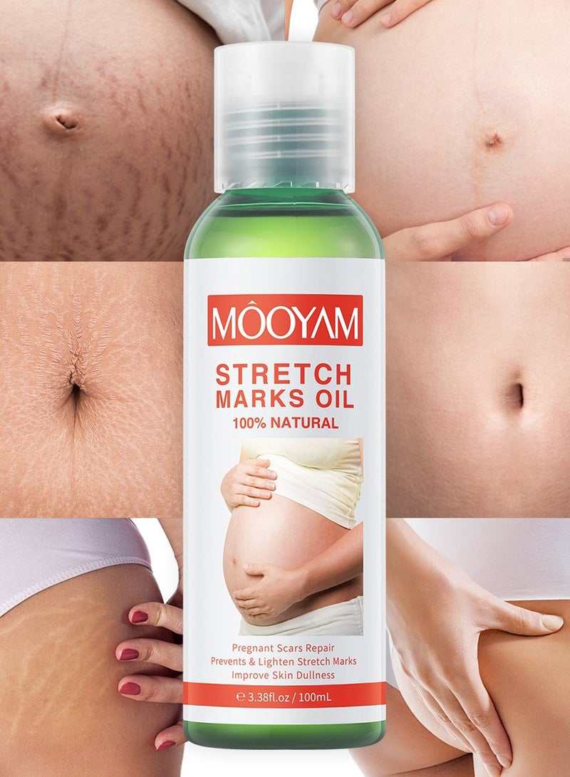 MOOYAM Stretch Marks Oil Natural for Pregnant Scars Repair Prevents and Lighten Stretch Marks Improves Skin Elasticity and Dullness for Women and Men 100ml - Image 1