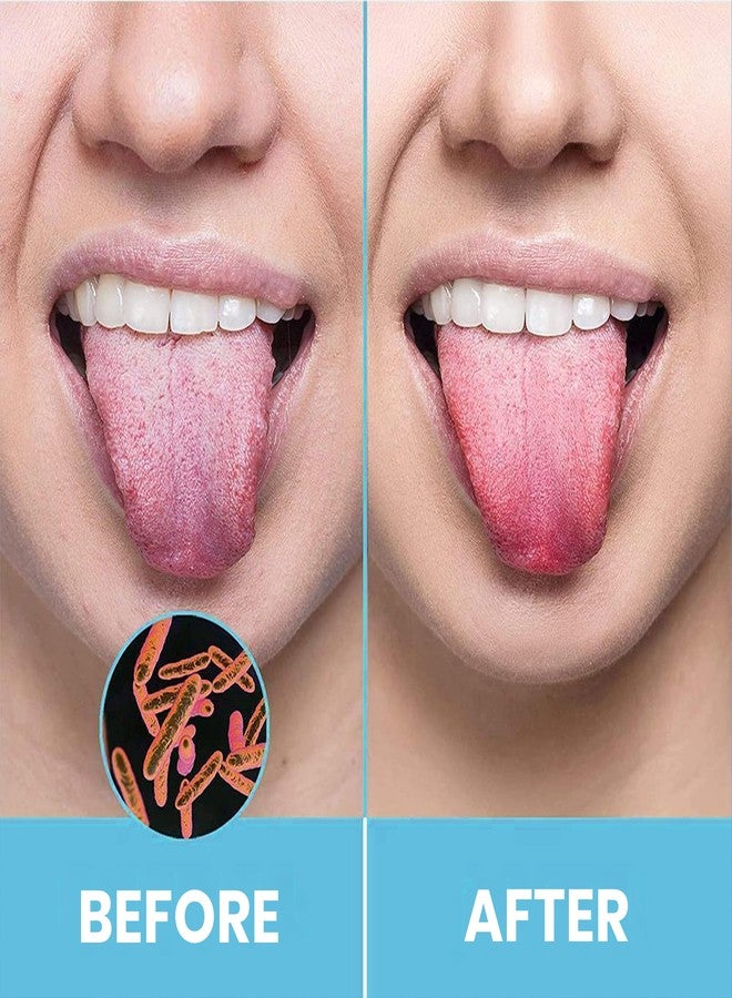 HOKIN Tongue Scraper for Adults by HOKIN (2Pcs Oral Care Pack Stainless Steel Tongue Cleaners Reduce Bad Breath 100% Metal Tough Scrapers Men and Women Hygiene Product - Image 2