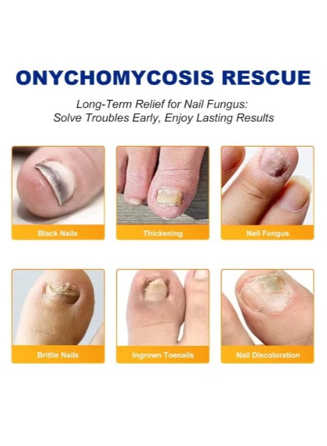 سيفودون علاج فطريات أظافر القدم بقوة إضافية - 32 قطعة من لاصقات الفطريات للأظافر، إصلاح الأظافر التالفة، تجديد ليلي للرجال والنساء - Image 3