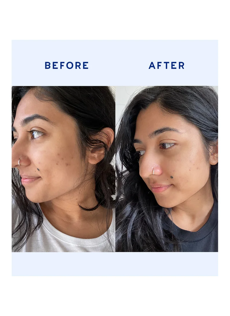 Aavrani Balance Restoring Face Serum + Free Gift