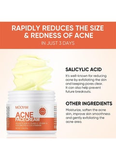MOOYAM Advanced Acne Treatment Cream Acne Face Cream Anti-Acne Moisturizer  - Image 4