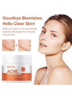 MOOYAM Advanced Acne Treatment Cream Acne Face Cream Anti-Acne Moisturizer  - Image 3