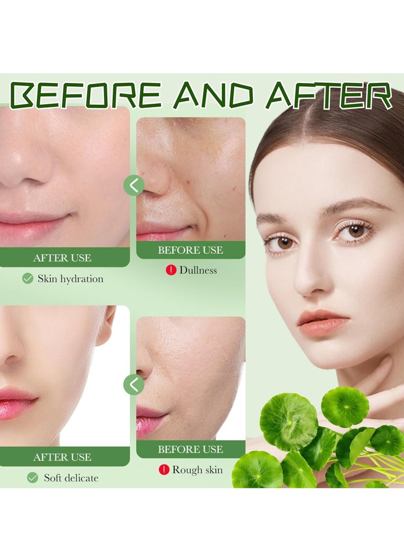 BARUBT Hydrating Centella Gel Cream, Moisturizer for Oily Skin, Calms Acne & Soothes Skin (55g) - Image 2