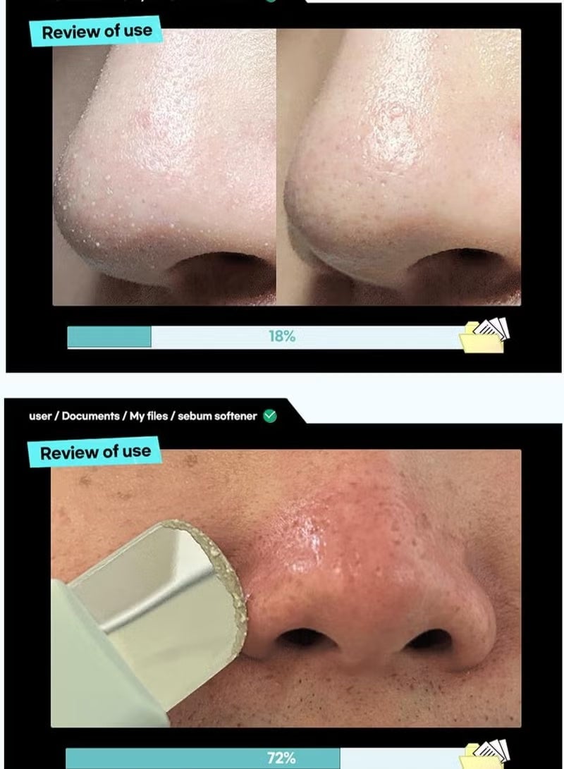 ilso Melting Sebum Softener, Pore Cleansing Solution, Melts Away Blackheads & Sebum - Image 5