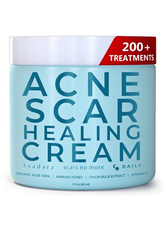 AYADARA Acne Scar Healing Cream, 2 Fl Oz, Acne Scar Treatment For Face, Stretch Marks, Body Scars, Acne Scar Removal Cream For Body, Acne Scar Remover For Cuts And Burns, For All Skin Types, 200+ Uses - Image 1