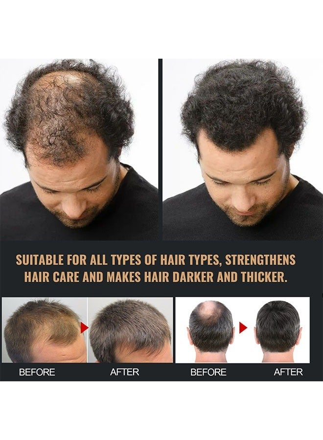 إيلهو شامبو منشط جذور الشعر تعزيز جذور الشعر لمنع تساقط الشعر ، الشعر الكثيف ، رقيق ، لينة وقوية إصلاح الشعر شامبو الرعاية - Image 5