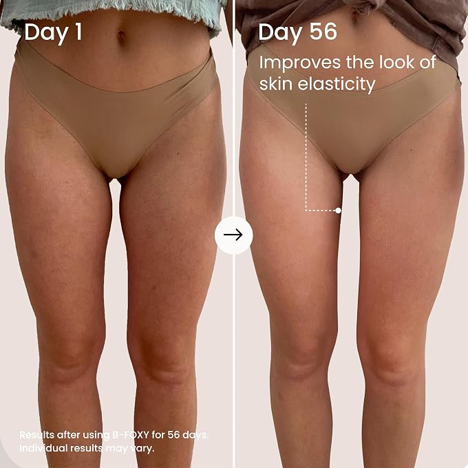 Maelys B-FOXY Inner Thigh Firming Cream - Tightens The Look Of Loose Skin & Helps Contour The Appearance Of Saggy Skin On The Inner Thighs - Image 3