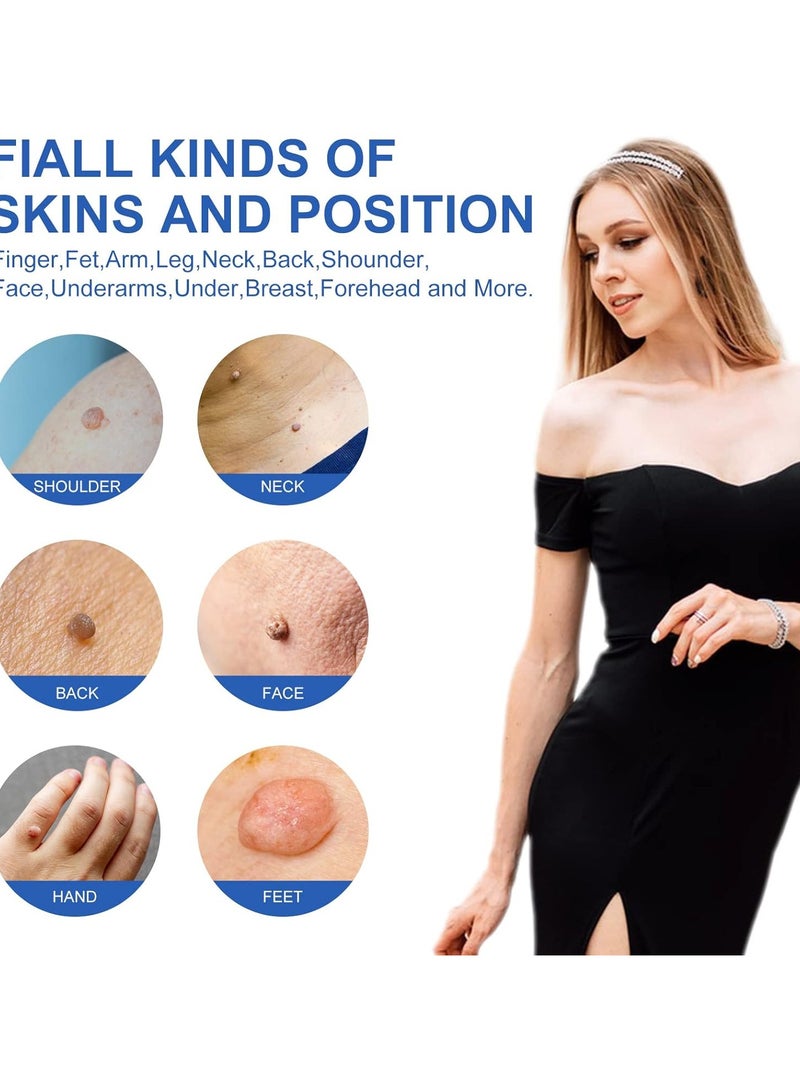 Sefudun Skin Tag Remover Device FDA-Cleared Safe and Effective Skin Tag Removal Kits Home Use - Image 3