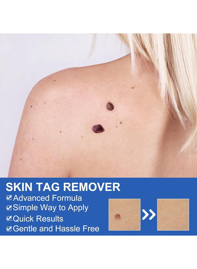 Sefudun Skin Tag Remover Device FDA-Cleared Safe and Effective Skin Tag Removal Kits Home Use - Image 4