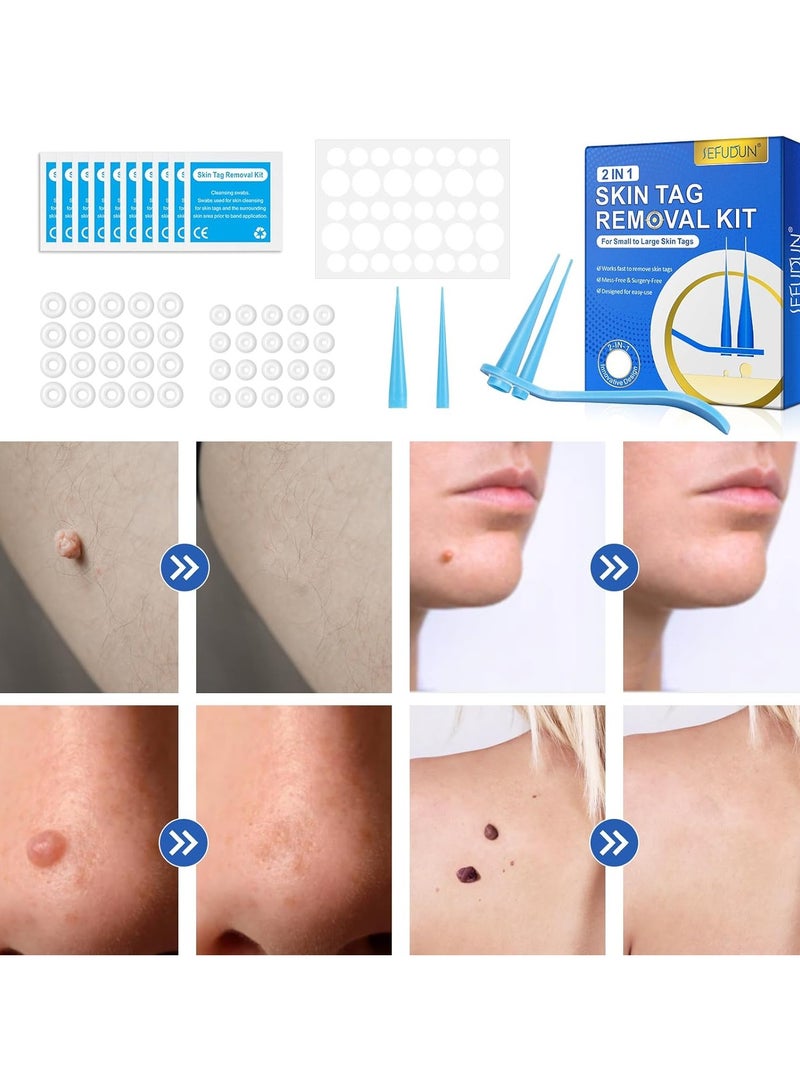 Sefudun Skin Tag Remover Device FDA-Cleared Safe and Effective Skin Tag Removal Kits Home Use - Image 5