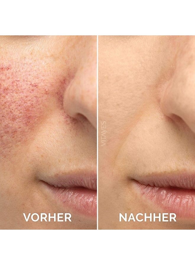 Vitayes Perfecter Vitamin C Serum for Face, Anti Aging Serum with Hyaluronic Acid. Skin Hydrating & Brightening Serum for Dark Spots, Fine Lines and Wrinkles. - Image 2