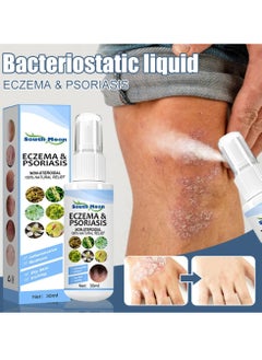 SOUTH MOON Herbal Psoriasis Relief Spray, Safe And Effective Eczema Soothing Spray, Simple And Convenient Herbal Psoriasis Soothing Mist, Quick Application Vitiligo Removal Relief For All Skin Types  - Image 3