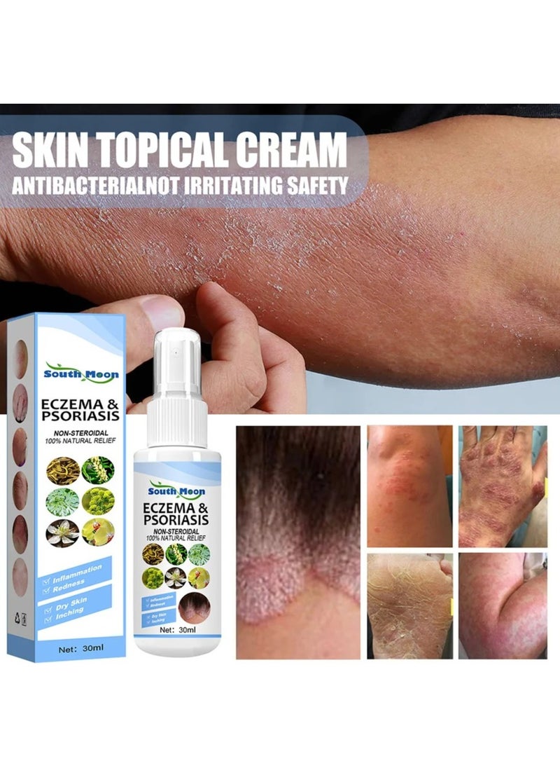 SOUTH MOON Herbal Psoriasis Relief Spray, Safe And Effective Eczema Soothing Spray, Simple And Convenient Herbal Psoriasis Soothing Mist, Quick Application Vitiligo Removal Relief For All Skin Types  - Image 4