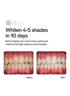 Opalescence Go - Prefilled Teeth Whitening Trays - Original 15% - (4 Treatments) - Hydrogen Peroxide with PF - Cool Mint - Made by Ultradent. 4648-1  - Image 4