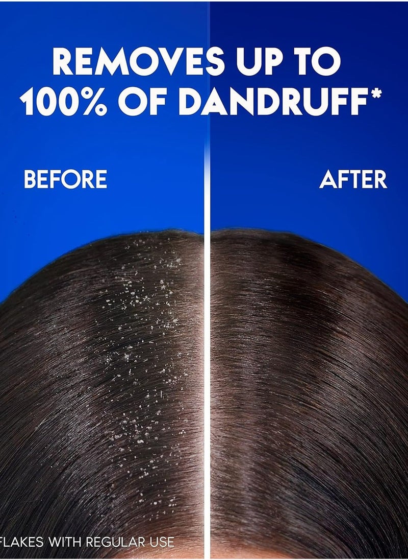 Head & Shoulders Anti-Dandruff Shampoo Citrus Fresh For Greasy Hair 400ML  - Image 2