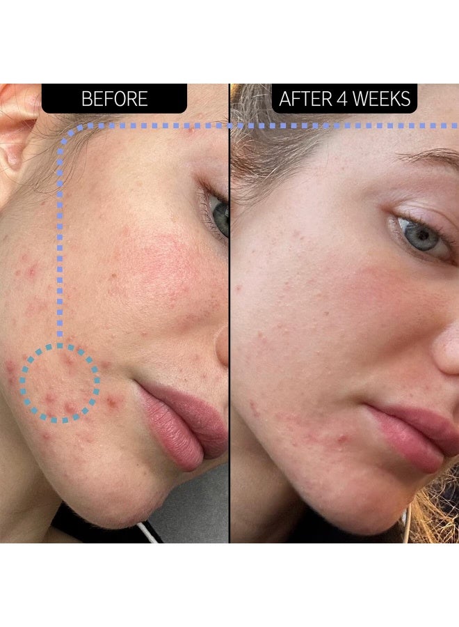 مرطب ذا إنكي ليست لإزالة الشوائب - 2% نوفوريتين™ - Image 4