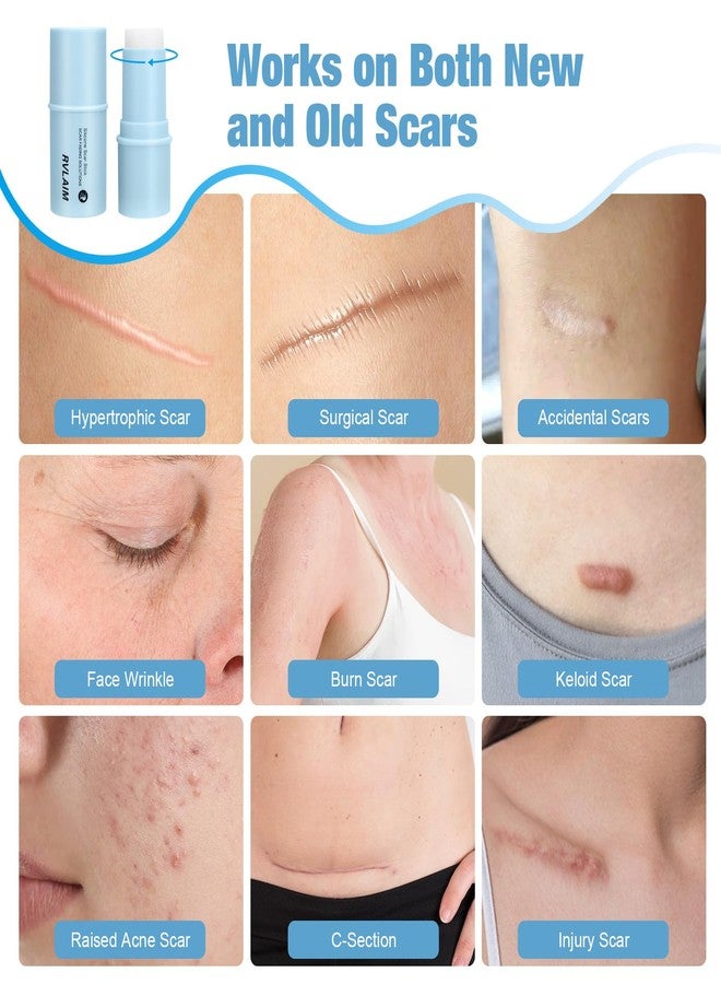 Rvlaim Silicone Scar Stick, 80% Silicone Stick for Face and Body. Silicone Stick for Removal of Surgical,Old and Recent Scars and Stretch Marks - 7g - Image 4
