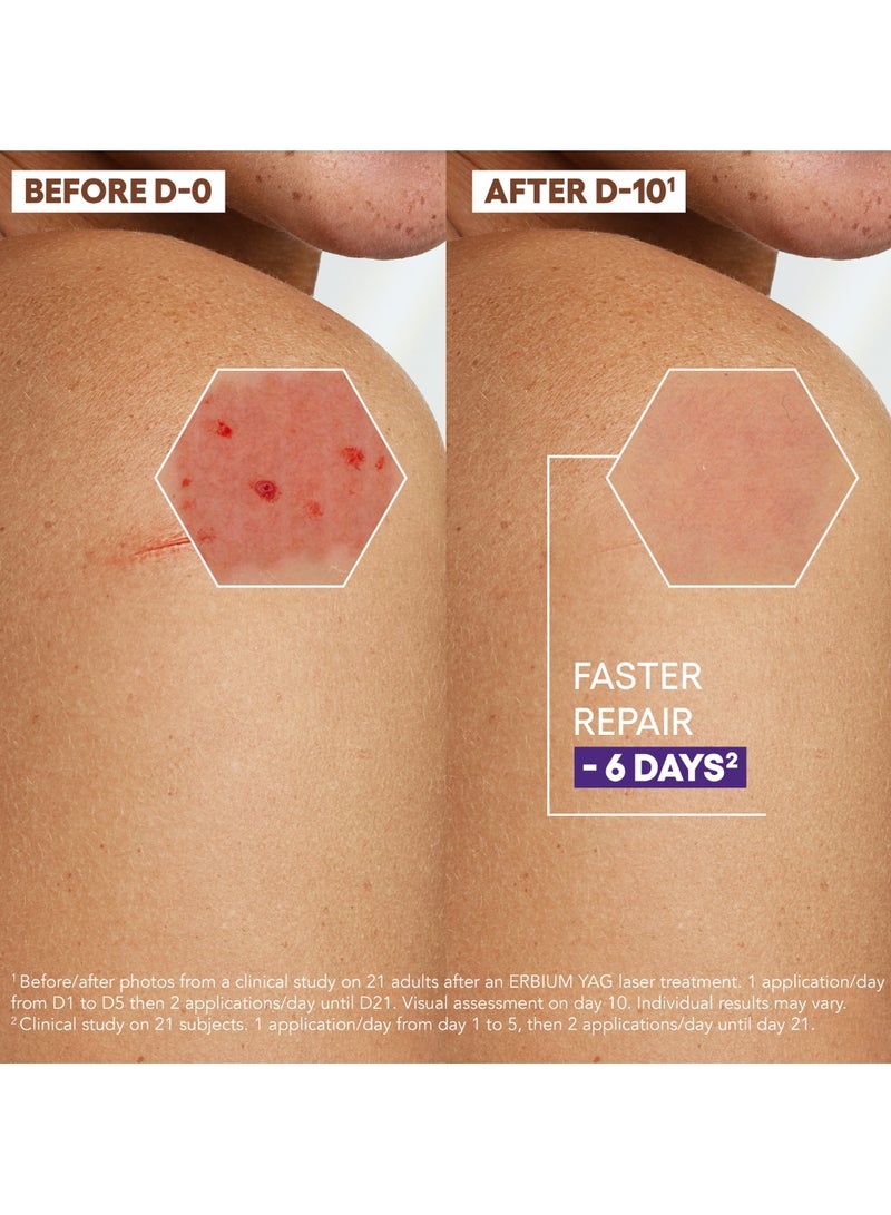 A-DERMA A Derma Epitheliale AH Ultra Repairing Cream Anti-Marks 40ml - Image 4