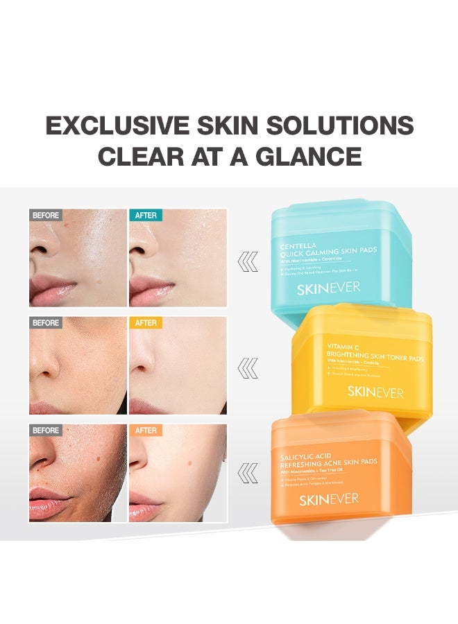 سكينيفر SKINEVER Vitamin C Brightening Toner Pads – Glow Boosting & Exfoliating Toner Pads for Radiant Skin - Image 4