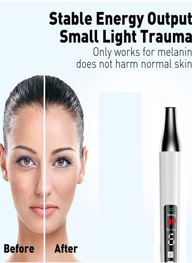 Generic - Handheld Laser Picosecond Skin Tattoo Dark Spot Removal Laser Pen Beauty Device（red light） - Image 1