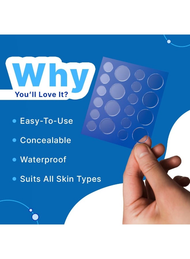 So True Sotrue Acne Pimple Patch for Face (20 dots) | Waterproof Patches for Active Acne | Absorbs Pimple Overnight and Reduces Excess Oil | Facial Patches with Hydrocolloid - Image 4