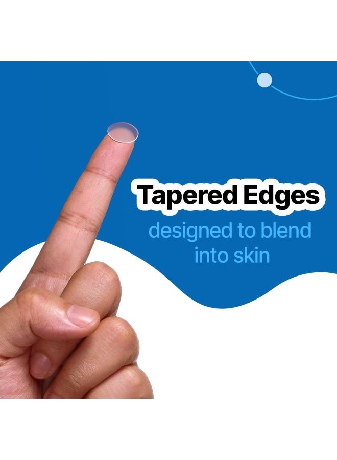 So True Sotrue Acne Pimple Patch for Face (20 dots) | Waterproof Patches for Active Acne | Absorbs Pimple Overnight and Reduces Excess Oil | Facial Patches with Hydrocolloid - Image 3