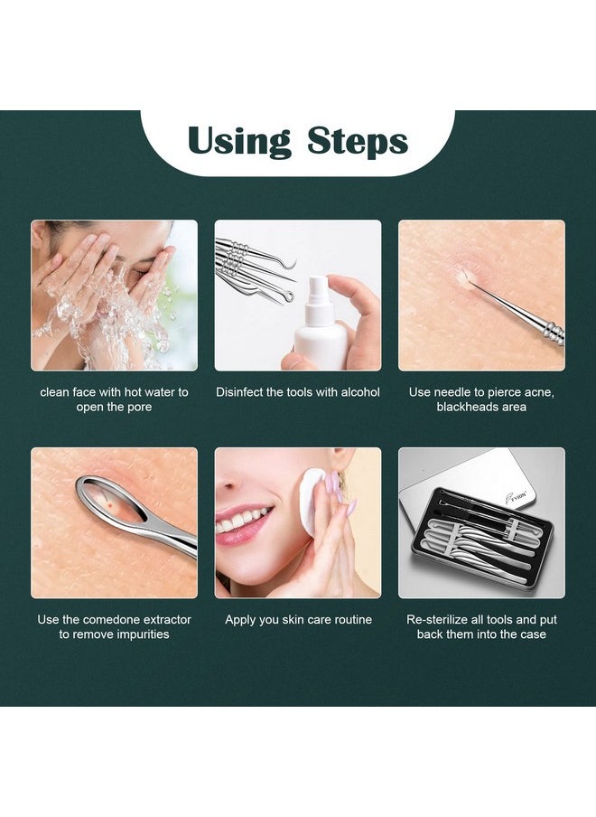 FVION - Blackhead And Acne Extractor Kit Professional Pimple Popper Tool Kit Acne Tweezers And Blackhead Remover Tools For Face 6 Pcs Surgical Extractor Pimple Popping Tools - Image 1
