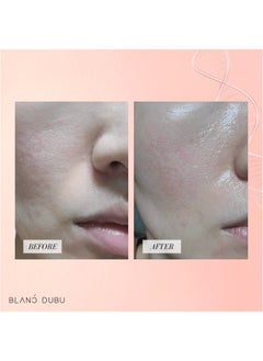BLANC DUBU BLANC DUBU NUBORN CELL Hydrogel Collagen Mask | Advanced Stem Cell Hydrogel Sheet Face Mask for Dry Skin | 2% Niacinamide, Hydrolyzed Collagen, Peptides and Hyaluronic Acids | Made in Korea 4-Pack  - Image 5