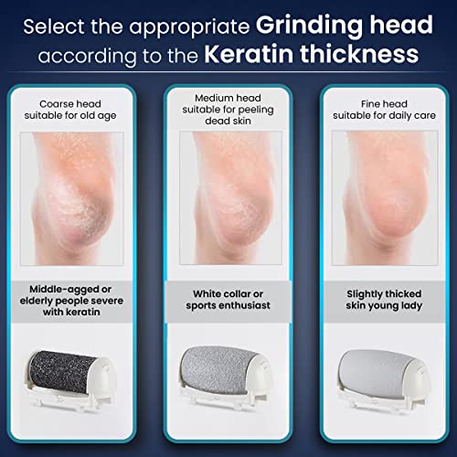 AGARO Callus Remover Replaceable Heads, 3 Pcs, Callus & Dead Skin Removal Filer, Pedicure At Home - Image 3