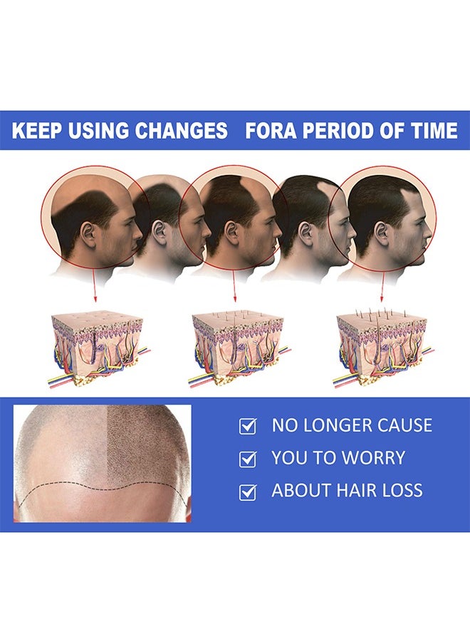 EELHOE - Ginger Hair Growth Spray, Regrowth Nourishing Ginger Spray, Ginger Spray For Hair Growth, Anti Hair Loss, Thinning, Balding, Repairs Hair, Use For Hair Loss and Hair Thinning Treatment Spray 30ML - Image 1