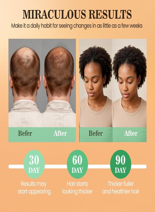 WEEMOTD Batana Oil for Hair Growth Dr Sebi, 100% Raw Organic Batana Hair Mask from Honduras, Wild Growth Hair Oil, Scalp Oil Promotes Hair Thickness, Prevents Loss for Men & Women (4.06 Fl Oz, Nutmeg) - Image 4