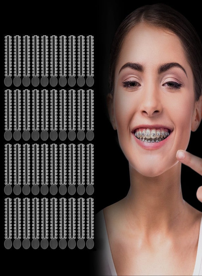 Annhua رباطات تقويم الأسنان أنهوى 1040 قطعة، أشرطة ملونة لتقويم الأسنان، رباطات مرنة على شكل حلقة - شفافة - Image 1