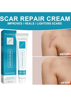 West&Month Scar Repair Cream Lightening Hyperplasia Pregnancy Surgery Burn Scar Skin Repair Scar Cream 20g  - Image 1
