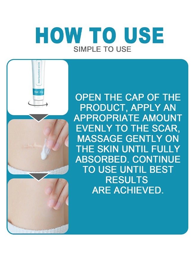 West&Month Scar Repair Cream Lightening Hyperplasia Pregnancy Surgery Burn Scar Skin Repair Scar Cream 20g - Image 3